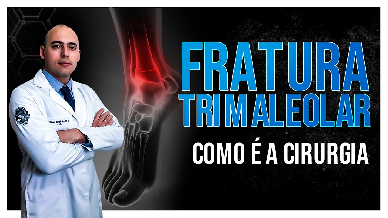 COMO É A CIRURGIA NO TORNOZELO | FRATURA DO MALÉOLO DA TÍBIA E FÍBULA | FRATURA TRIMALEOLAR