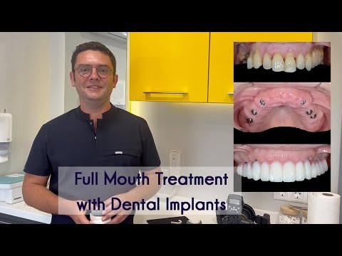 All on 6 Implant Treatment in Turkey & Full Mouth Dental Implants by Elit Dental Clinic Kusadasi