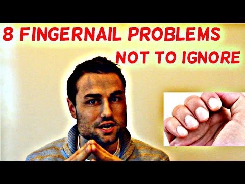Itlog sa suka halamang-singaw sa kanyang mga paa Hydrogen peroxide kapag tumatakbo paa halamang-singaw