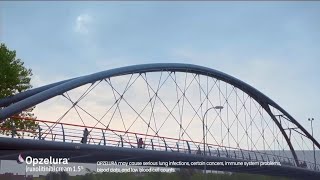 Opzelura Commercial #3 (2024, *Updated)