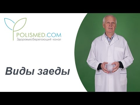 Виды заеды: кандидозная (дрожжевая, сифилитическая. Герпес или заеда? Здоровьесберегающий канал