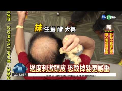 日本治禿療法 喝辣味噌湯有效?