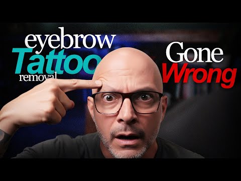 What Causes Brow Hair Loss During Laser PMU Removal