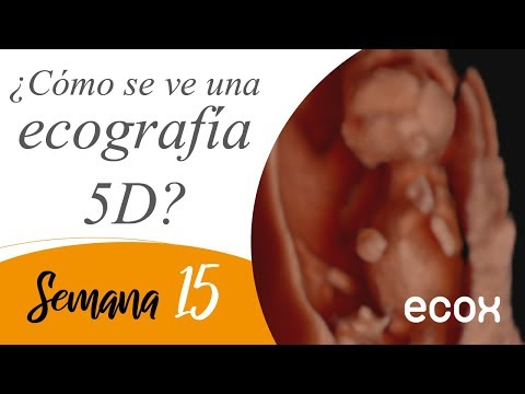Ecografia de 15 semanas de embarazo... Increíble 😮