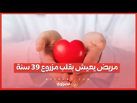 مريض يعيش بقلب مزروع 39 سنة إنجاز تاريخي لمجدي يعقوب