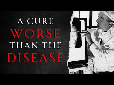 The History of the Lobotomy - ASMR History Learning