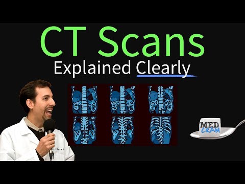 CT Scan of the Chest Explained Clearly - High Resolution CT Scan (HRCT)