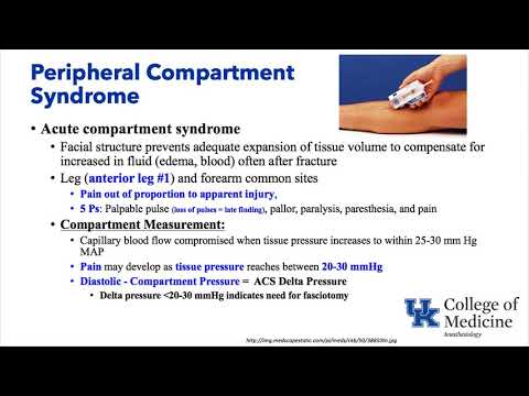 University of Kentucky Anesthesiology General Clinical - Ortho and Fluids - (Dr. Schell)