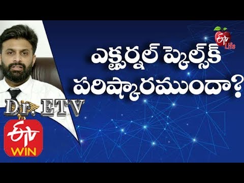 External Piles | External Hemorrhoids | External Hemorrhoid Treatment | Thrombosed Hemorrhoid