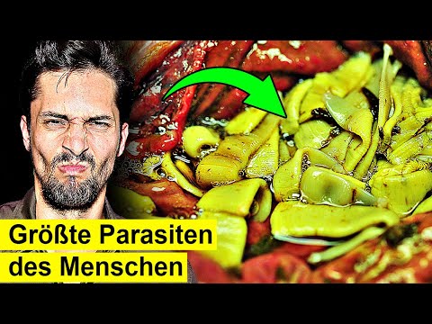 7 Meter Wurm plötzlich im Bauch! Ein gefährlicher Parasit?