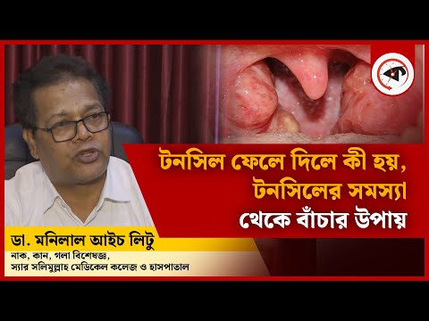 টনসিলের সমস্যা থেকে বাঁচার উপায় | Tonsils Treatment | Dr. Litu | Doctor Tips | Kalbela