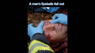 when the eyeballs are about to fall out #911 #chicagofire