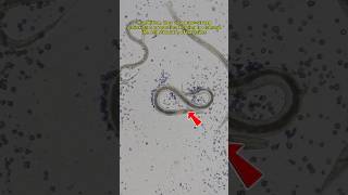 Ginger vs Human Parasites | TULO - Microscope#shorts #microscope #human