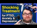 Transcranial Magnetic Stimulation PTSD Anxiety Depression Treatment TMS Therapy TheSITREP