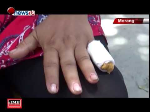 महिलाको औंला टोकेर चुडाइदिने अधिकारकर्मी पुरुष प्रहरीको फन्दामा - NEWS24 TV