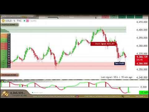 🟡GOLD XAU LIVE ULTIMATE CHART 24/7 ( M5 )