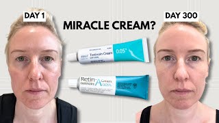 I Used Tretinoin for 300 days - here’s what happened to my skin (+ TIPS)