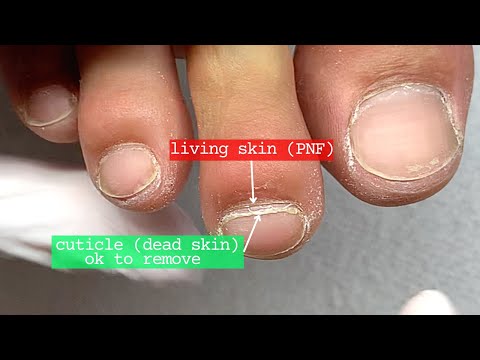 Don't Push Back the Cuticle.