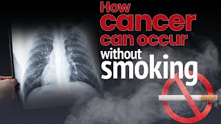 Dr Urvashi Prasad Shares Insights on ALK Lung Cancer: A Non-Smoking Related Rarity