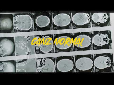 Kid Patron - Ganz Normal [HIP HOP] (prod. KIDPATRONBEATS)