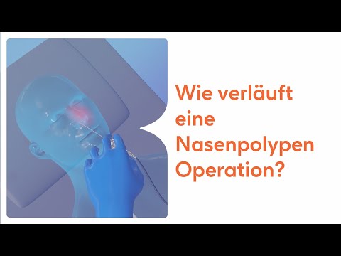 Wie verläuft eine Nasenpolypen Operation?