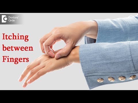 Itching between fingers : Finger Webspace Area | Cause & Cure -Dr. Rashmi Ravindra | Doctors' Circle