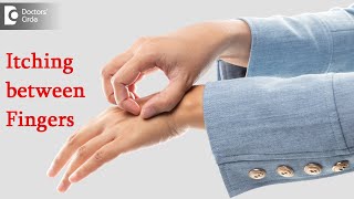 Itching between fingers : Finger Webspace Area | Cause & Cure -Dr. Rashmi Ravindra | Doctors