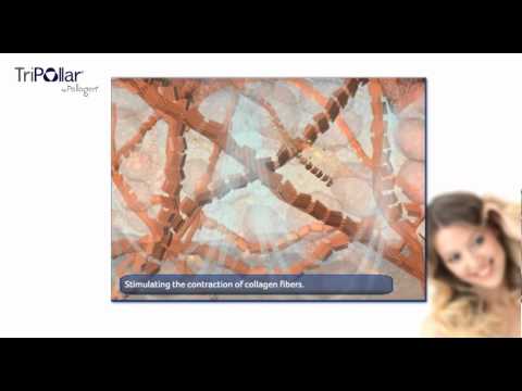  TriPollar Waiting Room Video
