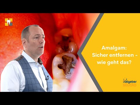 Amalgam - Wie lassen sich Amalgamfüllungen sicher entfernen?