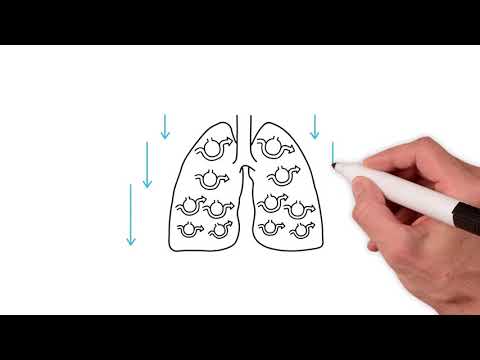 Everything you need to know about the ventilation perfusion ratio