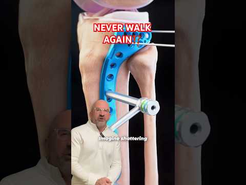 Tibia Bone Plates & Screws🪛 #shorts