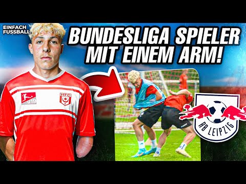 Mit einem Arm zum Bundesliga Profi? 😳