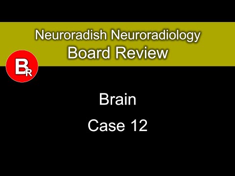 Neuroradiology Board Review - Brain Case 12