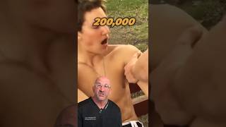 When Your Shoulder Pops 💥 Out #shorts