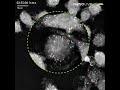 Capturing foam macrophage formation label free - Nanolive, Looking inside life Capturing foam macrophage formation label free
