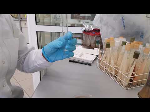 Technika posiewu powierzchniowego