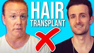 10 Reasons - Do Not Get A Hair Transplant