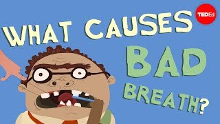 What causes bad breath? – Mel Rosenberg