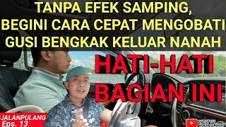 Download lagu MENGATASI GUSI KELU4R N4N4H & BENGK4K 100% KEMPES TANPA EFEK SAMPING ⁉️ #gusibernanah #gusibengkak mp3 Download lagu MENGATASI GUSI KELU4R N4N4H & BENGK4K 100% KEMPES TANPA EFEK SAMPING ⁉️ #gusibernanah #gusibengkak mp3