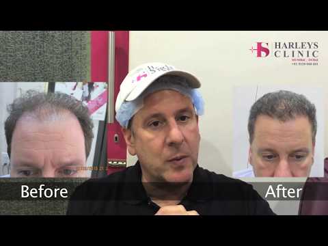 Harleys Hair Transplant Clinic in Mumbai Client Testimonial