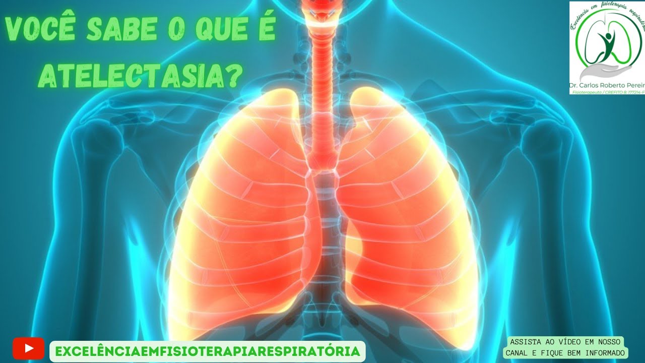 Entenda o que é Atelectasia e qual o papel do Powerbreathe na sua prevenção.