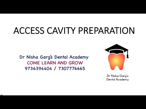 Access Cavity Preparation