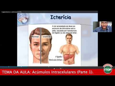 ENFERMAGEM - ACÚMULOS INTRACELULARES (PARTE 1 ) - Faculdade ITOP.