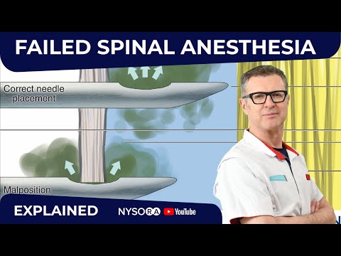 Failed Spinal Anesthesia Explained #1  - Regional anesthesia Crash course with Dr. Hadzic