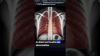 Proof of Concept: AI-powered X-Ray diagnosis tool enhances patient understanding
