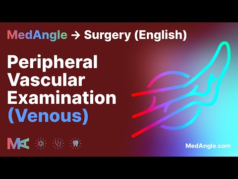 Peripheral Vascular Exam (Venous) - MedAngle Surgery (English)