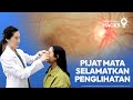 Tangani Emergensi Mata Dengan Pijatan