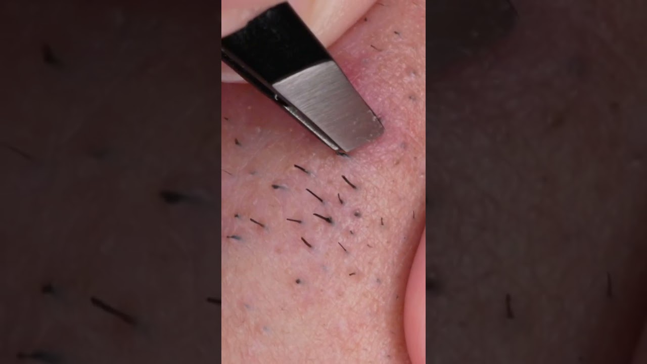 083 Can't catch it. #tweezers #毛抜き#shots