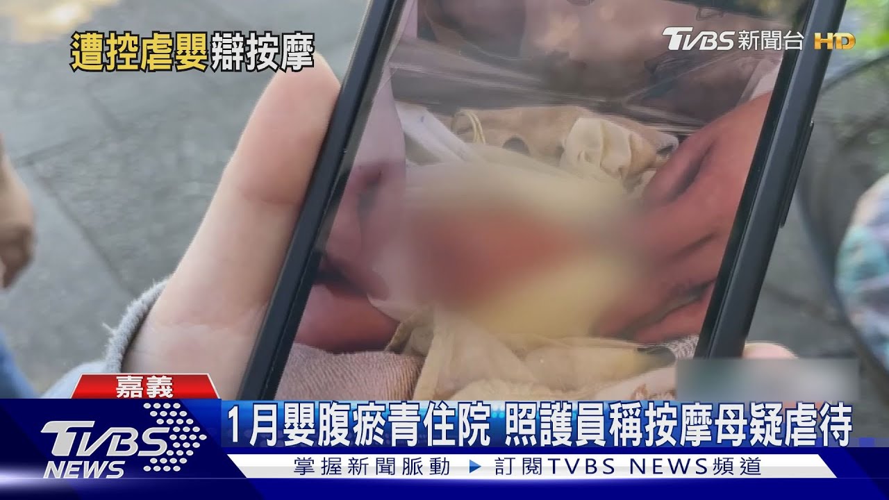 按摩太用力?新生兒腹部滿瘀青住院 母疑遭虐待怒轟