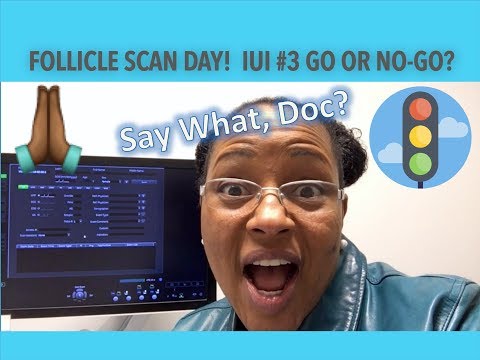 Is IUI # 3 a Go or No GO?? | It's My Mid-cycle Follicle Scan! | TTC~40 Video